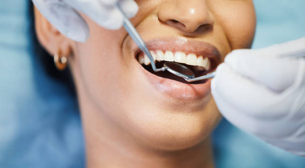 Best Emergency Root Canal Treatment in Dunwoody, GA
