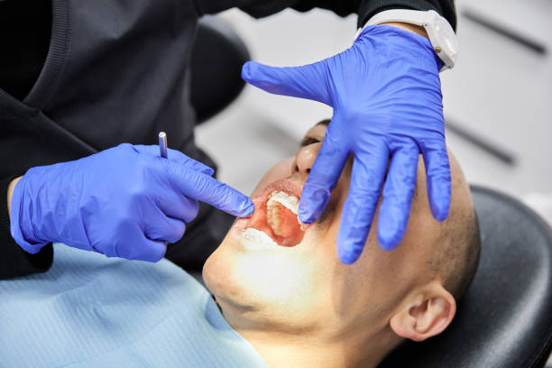 Best Emergency Dental Care for Abscessed Tooth in Dunwoody, GA