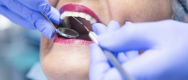 Best Emergency Root Canal Treatment in Dunwoody, GA